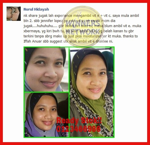 Awet Muda  buat duit dengan shaklee Cara Buat Duit Mudah dengan Shaklee cari pendapatan tambahan Energizing Soy Protein Jadi Ahli Shaklee Kesihatan Badan Kulit Licin kuruskan badan lechitin Masalah Jerawat master shaklee Mempercepat Proses Baik Luka Mencegah Pertumbuhan Abnormal Sel Meningkatkan Stamina Merawat Keletihan Peluang Perniagaan Shaklee Pengaliran Darah Lancar pengedar shaklee bertam pengedar shaklee bertam perdana pengedar shaklee bertam putra pengedar shaklee kedah pengedar shaklee kepala batas Pengedar shaklee penang pengedar shaklee perak pengedar shaklee sungai petani pengedar shaklee utara perniagaan dari rumah perniahgaan tanpa modal Produk Kecantikan shaklee shaklee murah stokis shaklee Vitamin E