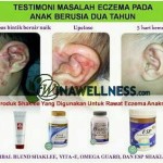 Testimoni Shaklee: Rawatan Eczema