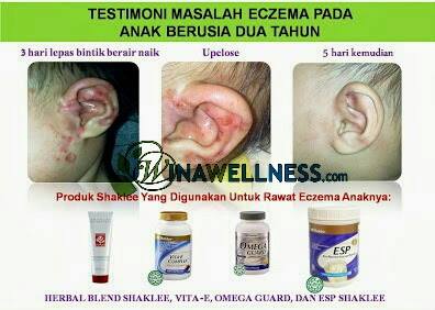 Shaklee kepala batas,shaklee bertam,shaklee sungai petani, ,shaklee bukit mertajam,shaklee butterworth,shaklee penang,shaklee kedah,shaklee utara,shaklee perak,shaklee nibong tebal,shaklee seberang perai,shaklee bertam,shaklee bertam putra ,shaklee bertam perdana,Shaklee tasek gelugor, Shaklee pulau pinang,Shaklee prai,Shaklee penaga,Shaklee Bandar perda