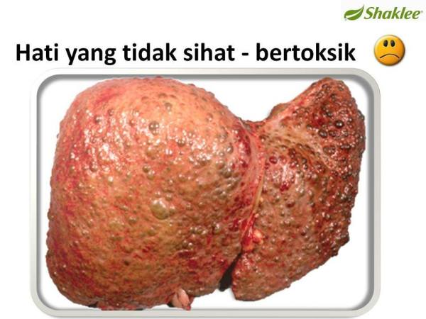 Pengedar Shaklee kepala batas,shaklee bertam,shaklee sungai petani,shaklee bukit mertajam,shaklee butterworth,shaklee penang,shaklee kedah,shaklee utara,shaklee perak,shaklee nibong tebal,shaklee seberang perai,shaklee bertam,shaklee bertam putra ,shaklee bertam perdana,Shaklee prai,Shaklee penaga,Shaklee Bandar perda,shaklee indonesia ,shaklee taiwan,shaklee sabah,shaklee malaysia,shaklee penaga   