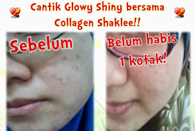 Pengedar Shaklee kepala batas,shaklee bertam,shaklee sungai petani,shaklee bukit mertajam,shaklee butterworth,shaklee penang,shaklee kedah,shaklee utara,shaklee perak,shaklee nibong tebal,shaklee seberang perai,shaklee bertam,shaklee bertam putra ,shaklee bertam perdana,Shaklee prai,Shaklee penaga,Shaklee Bandar perda,shaklee indonesia ,shaklee taiwan,shaklee sabah,shaklee malaysia,shaklee penaga