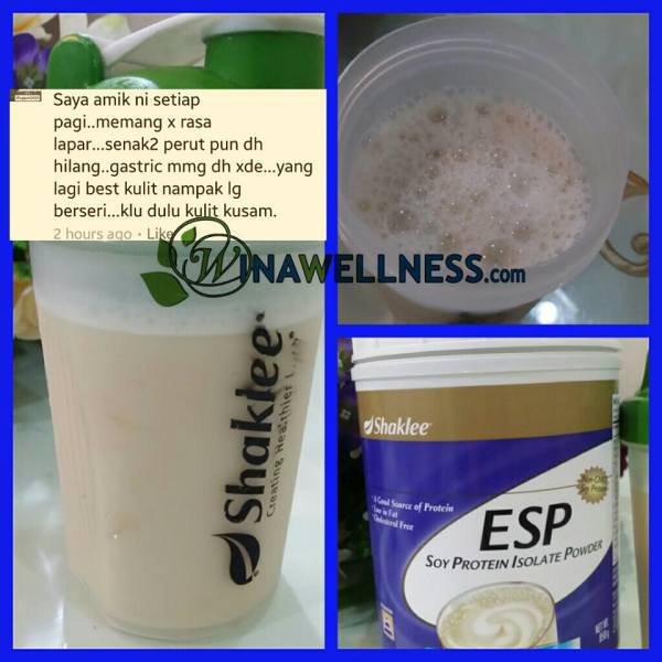 ESP ketika hamil,Kulit bayi cantik dengan ESP Shaklee,Shaklee kepala batas, shaklee bertam,shaklee bertam perdana, shaklee bertam putra , shaklee pulau pinang, shaklee penaga,shaklee sungai petani, shaklee seberang jaya, shaklee butterwoth, shaklee bukit mertajam, shaklee kedah, Testimoni ESP Shaklee 