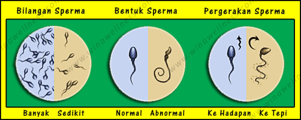 sperm-quality, perbezaan sperma, kualiti sperma, banyakkan sperma