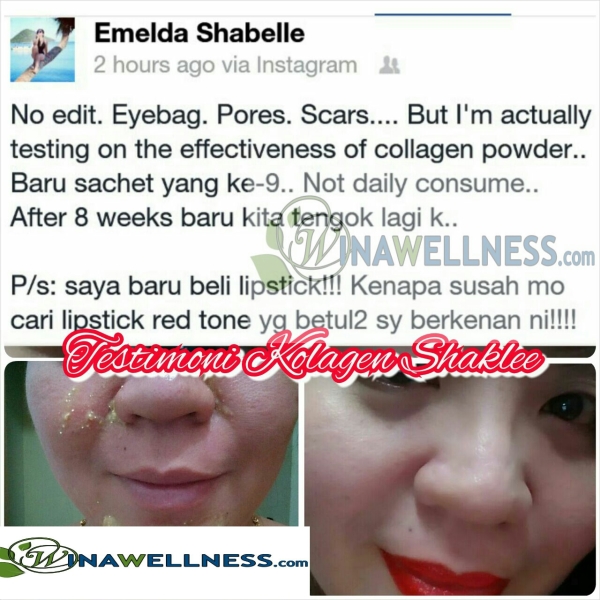 Kenapa Mesti Pilih Collagen Powder Shaklee, shaklee bertam, shaklee bertam perdana, shaklee bertam putra, shaklee bukit mertajam, shaklee butterwoth, shaklee kedah, Shaklee kepala batas, shaklee malaysia, Shaklee penaga, Shaklee pulau pinang, shaklee seberang jaya, shaklee sungai petani, Testimoni Collagen Powder Shaklee, Testimoni Collagen Powder Shaklee anjalkan Payudara, Testimoni Collagen Powder Shaklee Tegangkan kulit, Testimoni Collagen Powder ShakleeHilangkan Jeragat