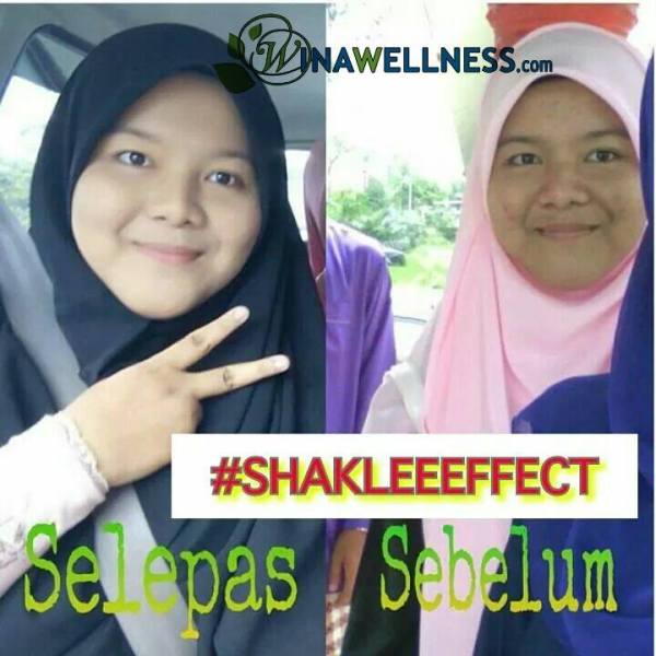 Testimoni Set Penjagaan Kulit Enfuselle ,Bahaya kosmetik murahan,Shaklee kepala batas, shaklee bertam,shaklee bertam perdana, shaklee bertam putra , shaklee pulau pinang, shaklee penaga,shaklee sungai petani, shaklee seberang jaya, shaklee butterwoth, shaklee bukit mertajam, shaklee kedah, shaklee malaysia, 