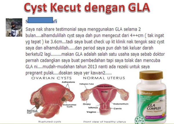 Set  rawatan fibroid  dan cyst Shaklee kepala batas, shaklee bertam,shaklee bertam perdana, shaklee bertam putra , shaklee pulau pinang, shaklee penaga,shaklee sungai petani, shaklee seberang jaya, shaklee butterwoth, shaklee bukit mertajam, shaklee kedah, shaklee malaysiaShaklee kepala batas, shaklee bertam,shaklee bertam perdana, shaklee bertam putra , shaklee pulau pinang, shaklee penaga,shaklee sungai petani, shaklee seberang jaya, shaklee butterwoth, shaklee bukit mertajam, shaklee kedah, shaklee malaysia,bahaya fibroid dan cyst