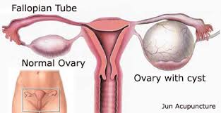 Set  rawatan fibroid  dan cyst Shaklee kepala batas, shaklee bertam,shaklee bertam perdana, shaklee bertam putra , shaklee pulau pinang, shaklee penaga,shaklee sungai petani, shaklee seberang jaya, shaklee butterwoth, shaklee bukit mertajam, shaklee kedah, shaklee malaysiaShaklee kepala batas, shaklee bertam,shaklee bertam perdana, shaklee bertam putra , shaklee pulau pinang, shaklee penaga,shaklee sungai petani, shaklee seberang jaya, shaklee butterwoth, shaklee bukit mertajam, shaklee kedah, shaklee malaysia,bahaya fibroid dan cyst