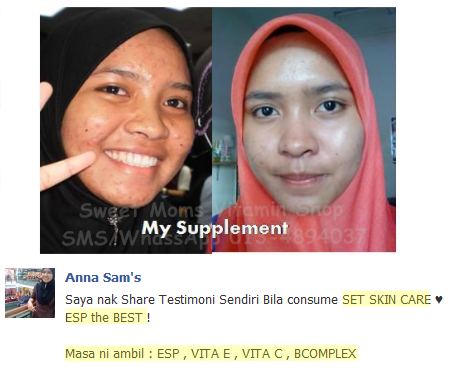 shaklee bertam, shaklee bertam perdana, shaklee bertam putra, shaklee bukit mertajam, shaklee butterwoth, shaklee kedah, Shaklee kepala batas, shaklee malaysia, Shaklee penaga, Shaklee pulau pinang, shaklee seberang jaya, shaklee sungai petani, testimoni vitamin c shaklee, testimoni vitamin e shaklee