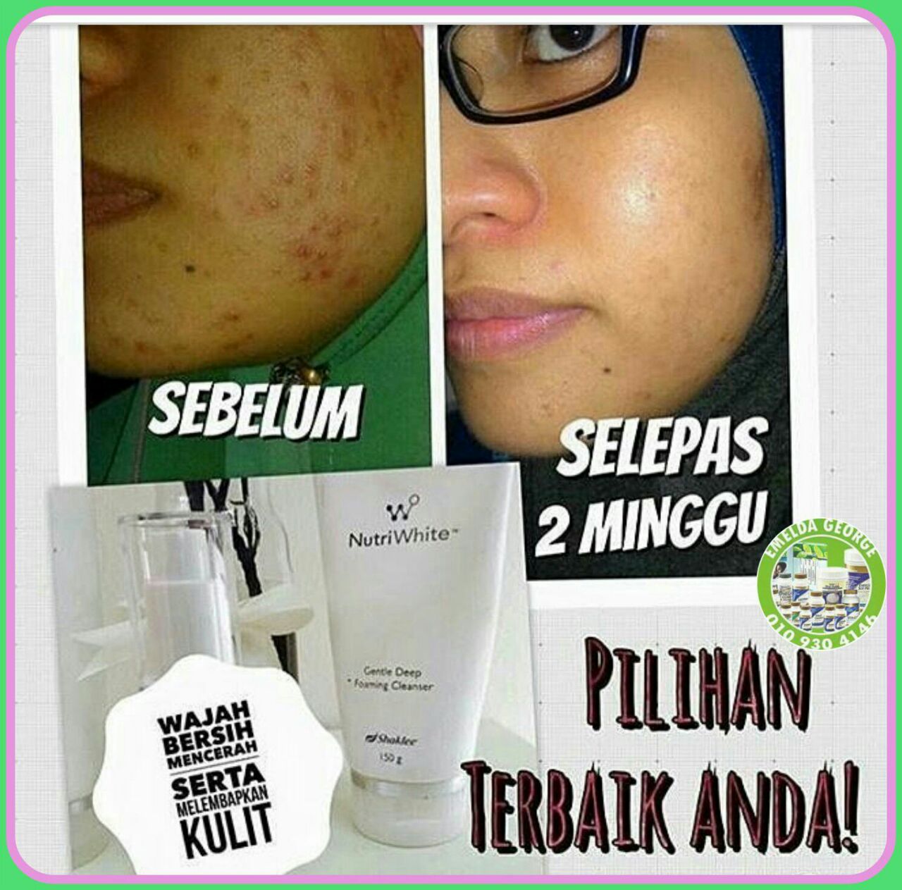 Testimoni Nutriwhite Deep Foaming Cleanser 