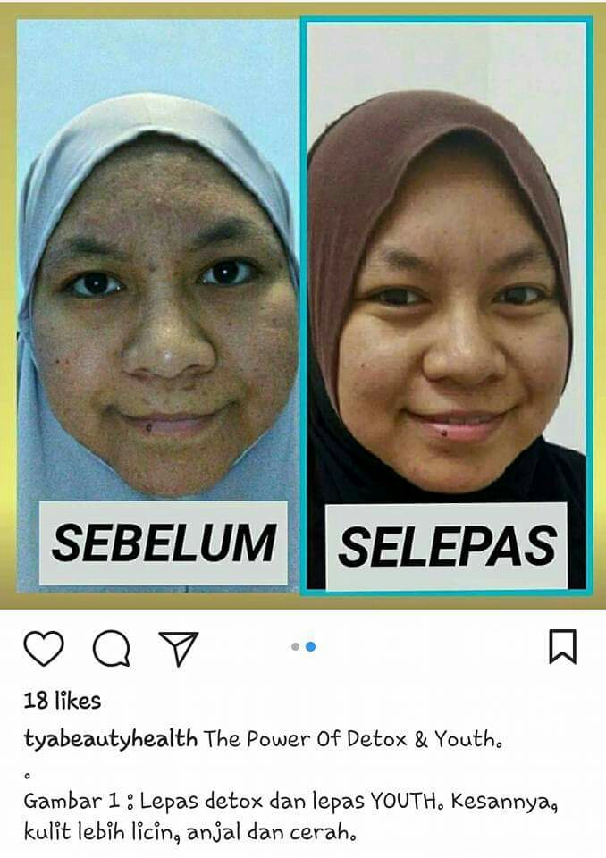 Testimoni Youth SkinCare Shaklee