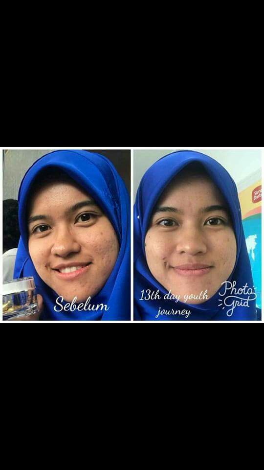 Testimoni Youth SkinCare Shaklee