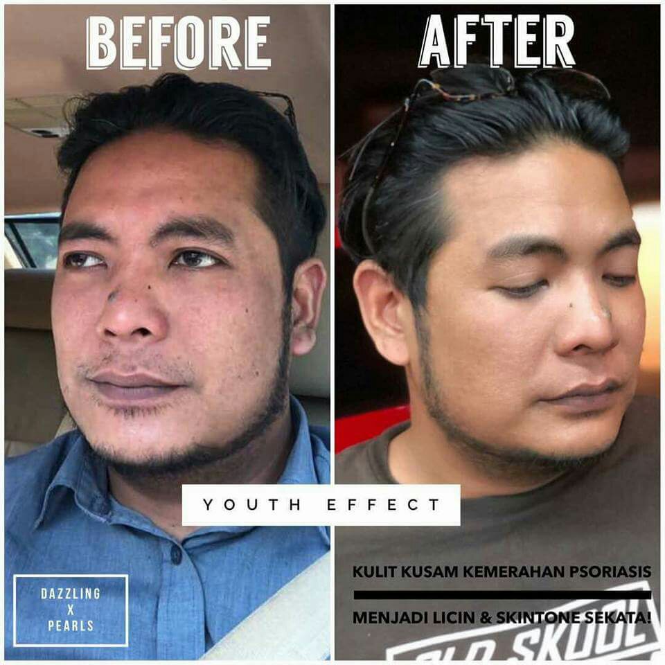 Testimoni Youth SkinCare Shaklee