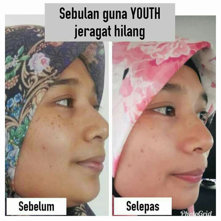 Pengedar Shaklee Kepala Batas:Youth  SkinCare Organik Yang Berkesan 