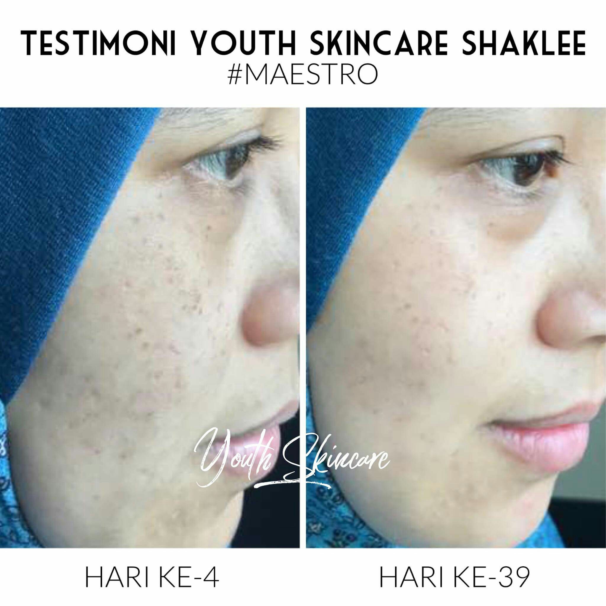 Pengedar Shaklee Kepala Batas:Youth  SkinCare Organik Yang Berkesan 