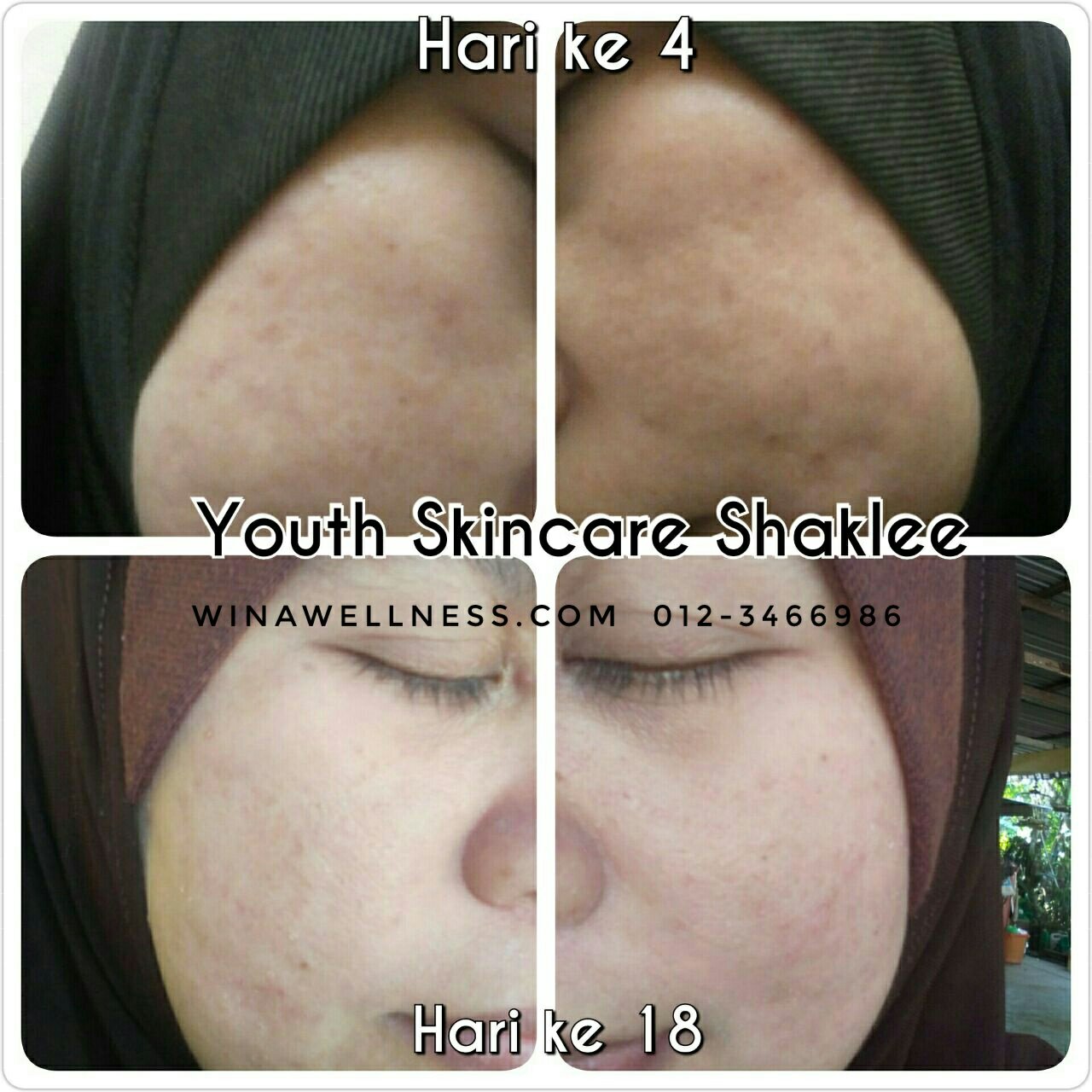 Pengedar Shaklee Kepala Batas:Youth  SkinCare Organik Yang Berkesan 