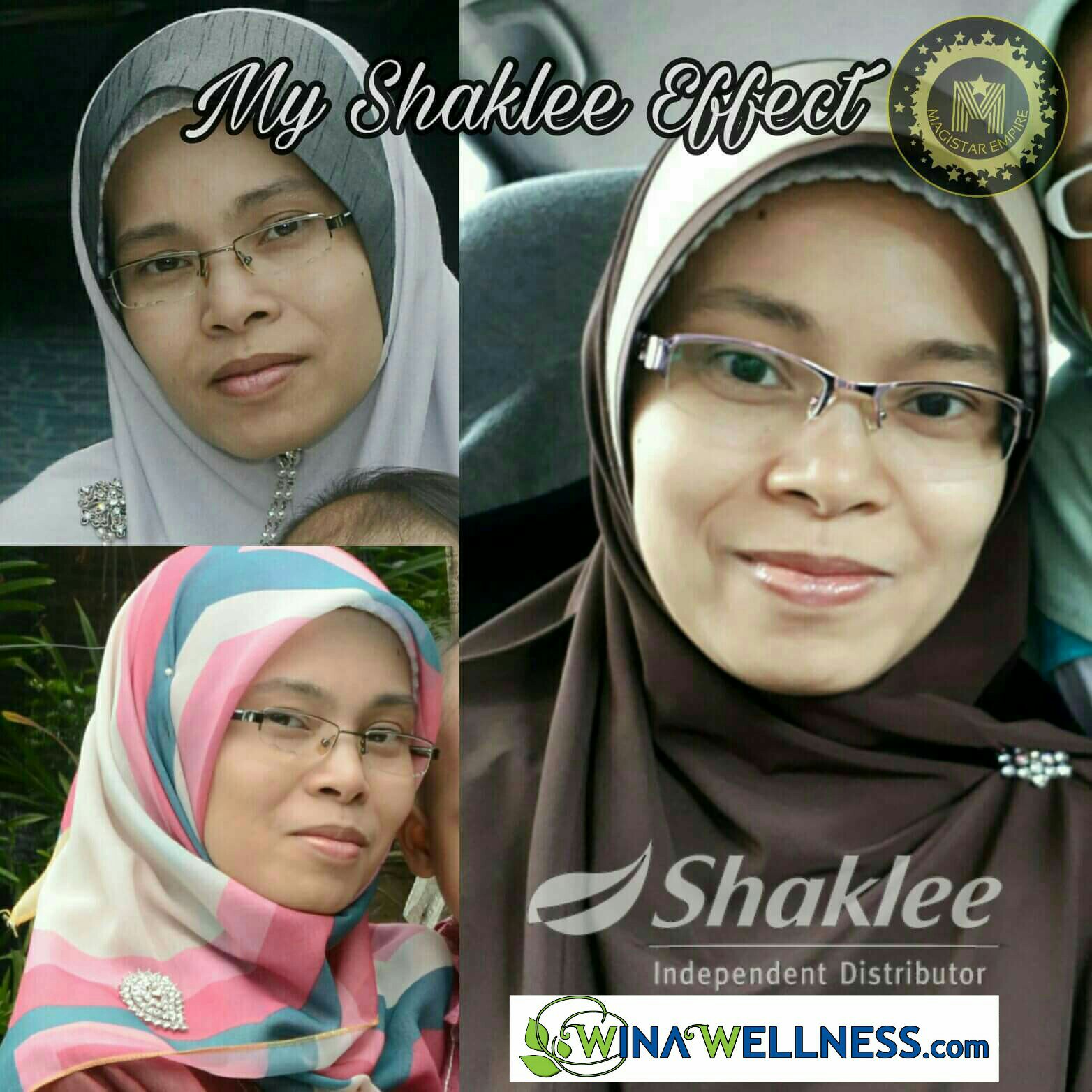 Pengedar Shaklee Kepala Batas:Youth  SkinCare Organik Yang Berkesan 