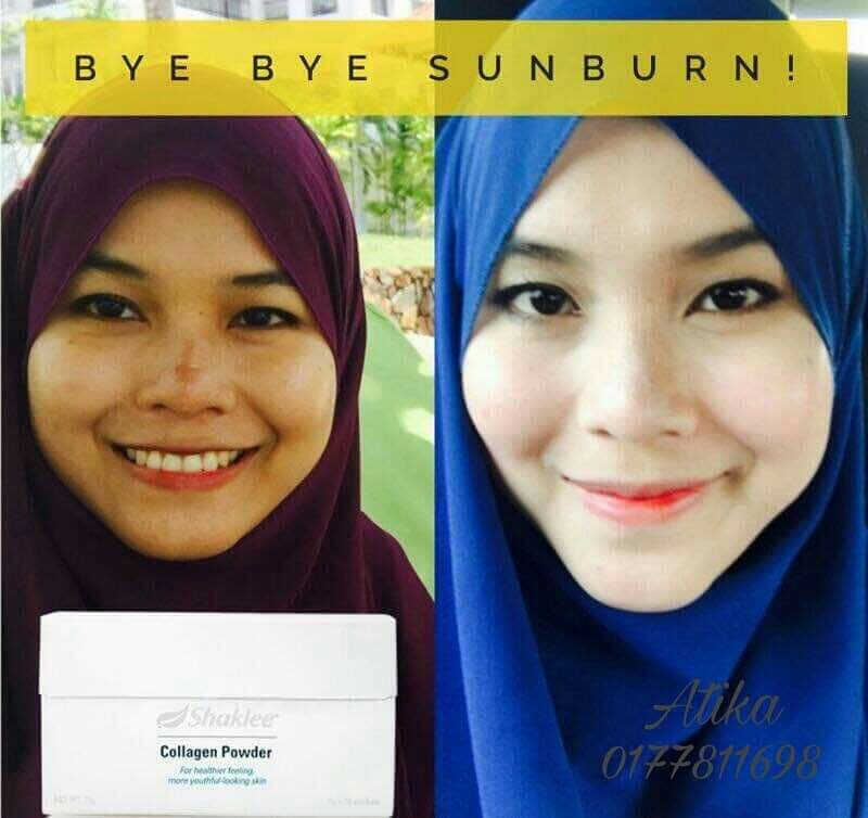 Testimoni Collagen Powder Shaklee