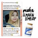 Tips Lembabkan Kulit Muka