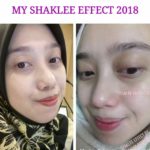 Shaklee Penang:Testimoni Vitamin C Shaklee