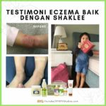 Testimoni Eczema Baik Dengan Shaklee-Pengedar Shaklee Bertam Kepala Batas