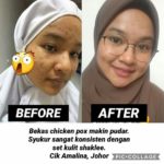 Vitamin C Shaklee Putihkan Kulit-Pengedar Shaklee Bertam Kepala Batas