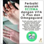 Testimoni Set Ekzema Shaklee