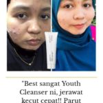 Pengedar Shaklee Bertam Kepala Batas Ready Stock:Youth Skin Care