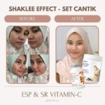 Vitamin Kulit Cantik Harga Rahmah