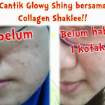 Collagen paling berkesan