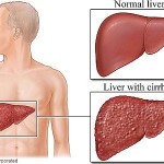 Vitamin Untuk Hati