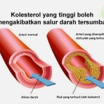 Shaklee Penang: Garlic Menurunkan kolestrol