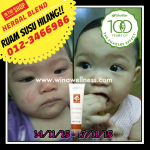 Shaklee Bertam:Testimoni Ruam Susu Hilang Dengan Herbalblend Shaklee