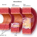 Shaklee Penang :ESP Merendahkan Kolesterol?