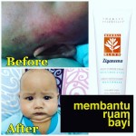 Shaklee Bertam :Testimoni Herbalblend Untuk Ruam Bayi