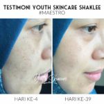 Pengedar Shaklee Kepala Batas:Testimoni Youth Hilangkan Jeragat