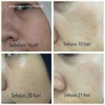 Youth SkinCare Yang Selamat Dan Berkesan