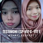 Testimoni Set Kecantikan Kulit Shaklee