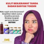 22 Tanda Badan Anda Kekurangan Nutrisi