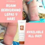 Shaklee Kepala Batas:Herbalblend Untuk Ruam Bayi