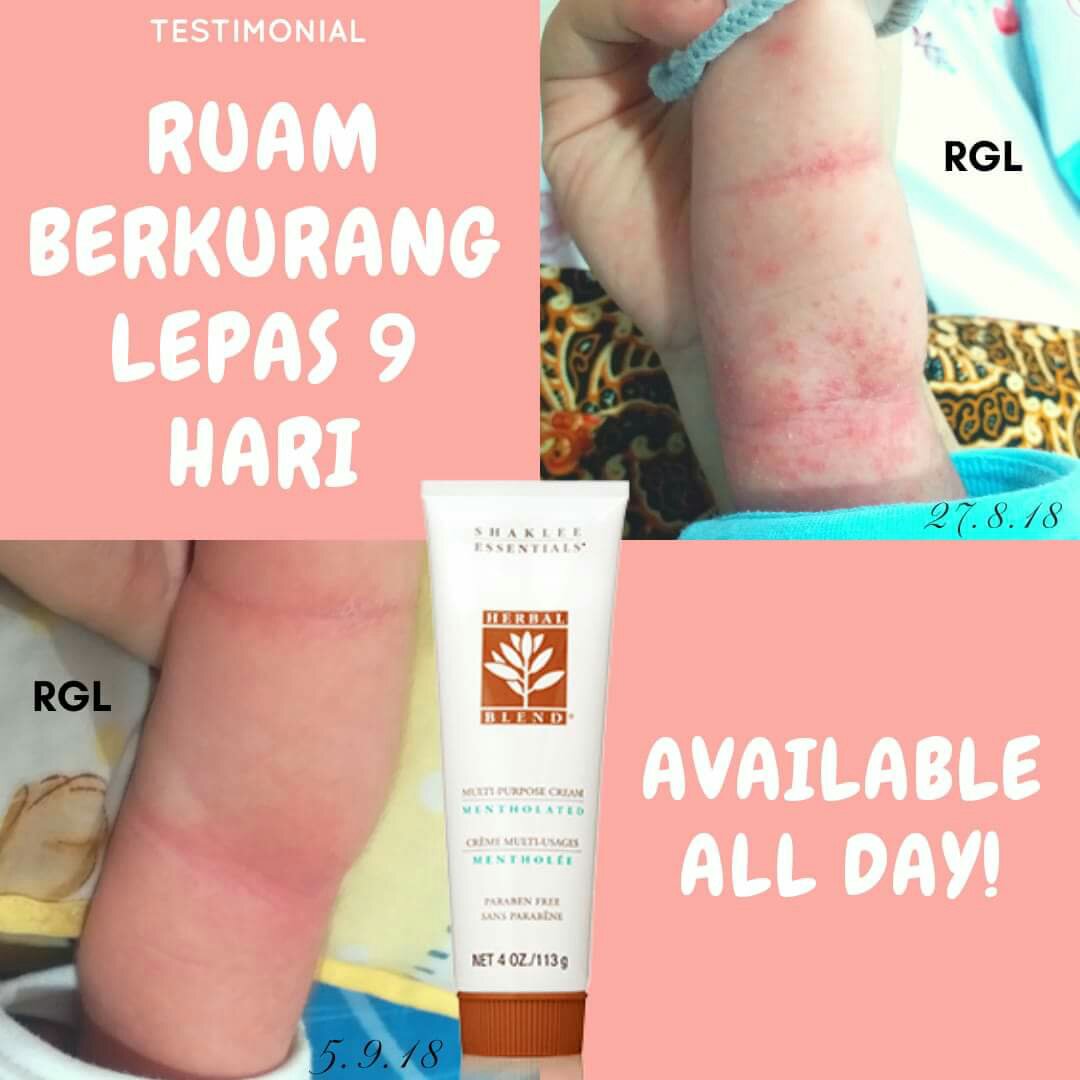 Shaklee Kepala Batas:Herbalblend Untuk Ruam Bayi