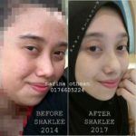 Kulit Makin Cantik Dengan Vitamin Shaklee