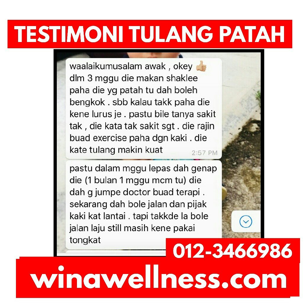 Testimoni Ostemetrix Untuk Tulang Patah Kemalangan 