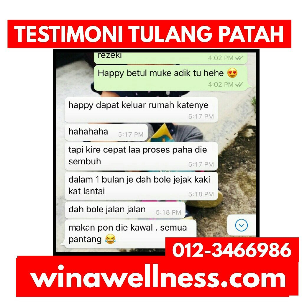 Testimoni Ostemetrix Untuk Tulang Patah Kemalangan