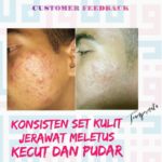 Shaklee Kepala Batas:Testimoni Set Kecantikan Kulit Khaklee