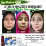 Vitamin C Shaklee Cerahkan Kulit-Shaklee Penang