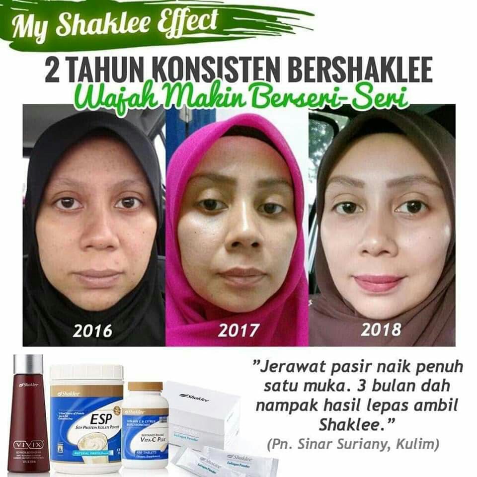 Vitamin C Shaklee Cerahkan Kulit-Shaklee Penang