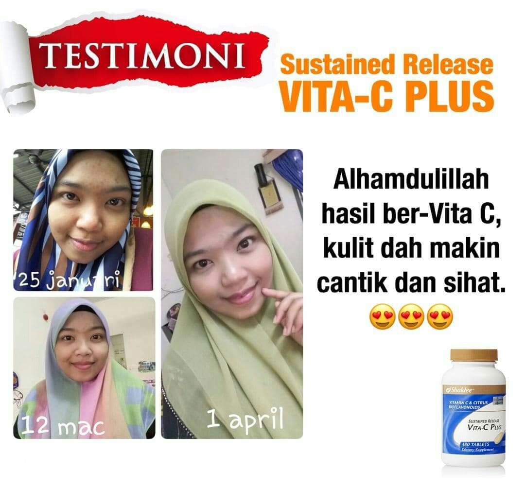 Pengedar Shaklee Kepala Batas, Pengedar Shaklee Bertam,Pengedar Shaklee Bertam perdana,Pengedar Shaklee Bertam Putera,Pengedar Shaklee Bertam Indah,Pengedar Shaklee Tasek Gelugur,Pengedar Shaklee Penaga,Pengedar Shaklee Penang,Pengedar Shaklee Bukit Mertajam,Pengedar Shaklee Sungai Petani,Pengedar Shaklee Butterworth,Pengedar Shaklee Kulim