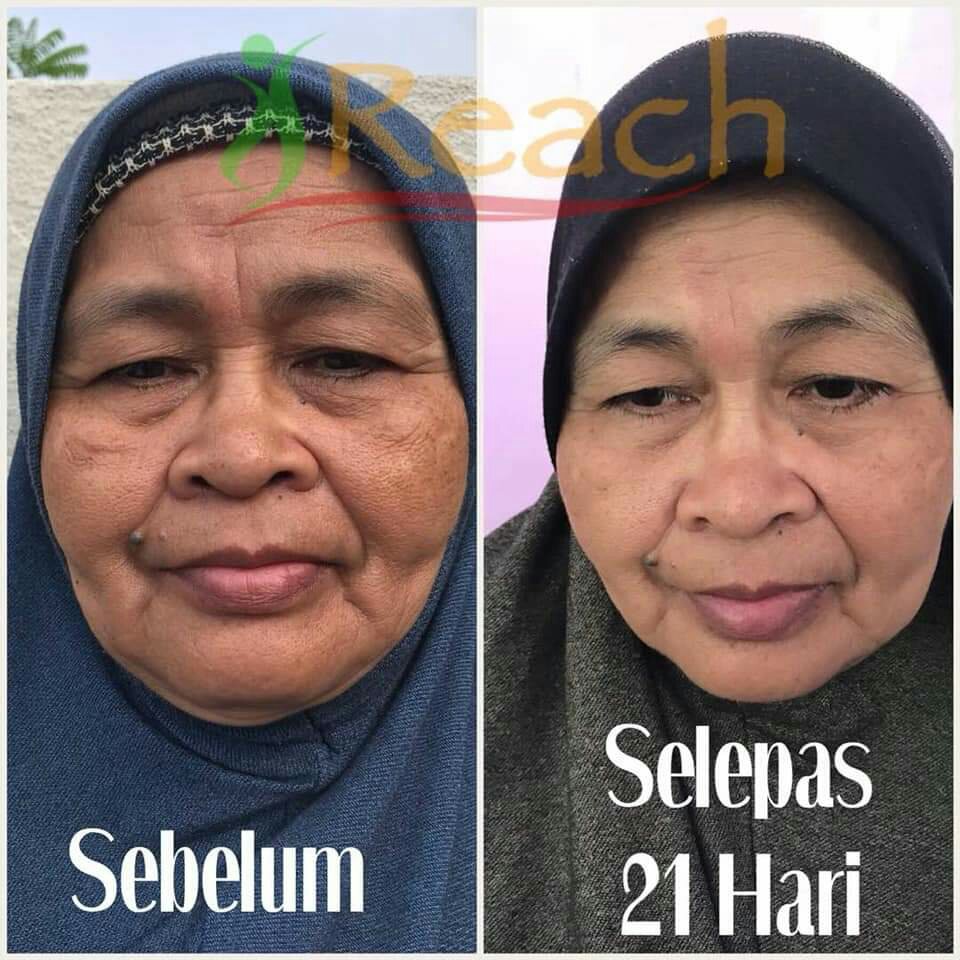 Apa Beza YOUTH SHAKLEE dan Skincare lain di pasaran?-Pengedar Shaklee Penang