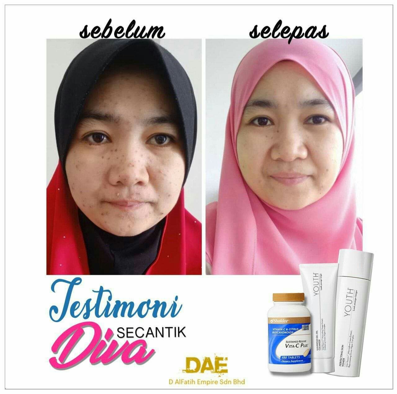 TIPS HILANGKAN PARUT JERAWAT-Pengedar Shaklee Penang