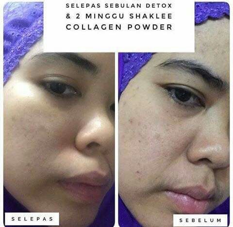 Harga Shaklee Collagen Powder-Pengedar Shaklee Penang